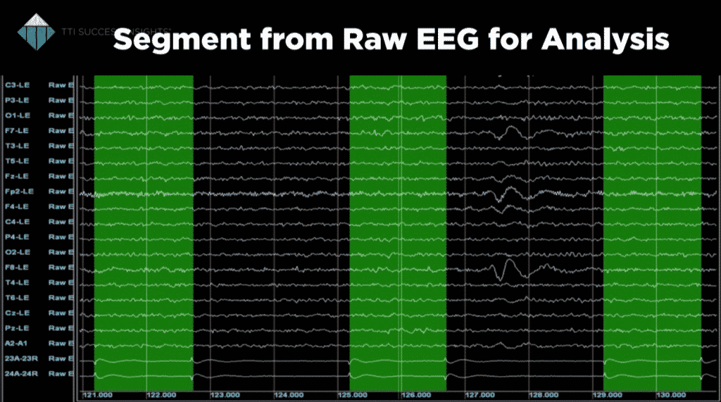 Validated Talent Management Assessments - Segment From Raw EEG for Analysis